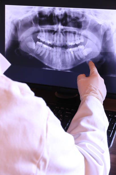 Best Urgent Care for Lost Fillings or Crowns in Shougal, WA