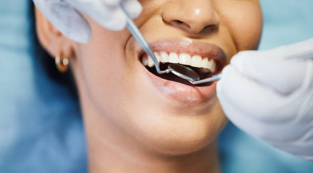 Best Emergency Dental Care for Broken or Chipped Teeth in Shougal, WA